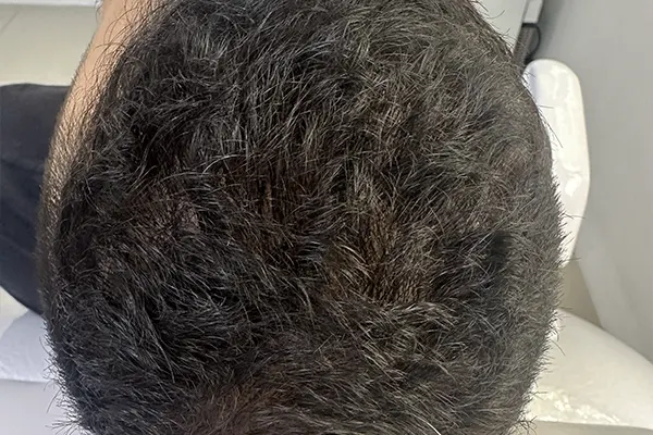 Img-Dra_Alexandra_Salazar-Antes&Despues-10-Despues