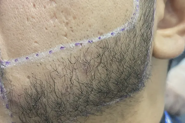 Img-Dra_Alexandra_Salazar-Antes&Despues-11-Antes