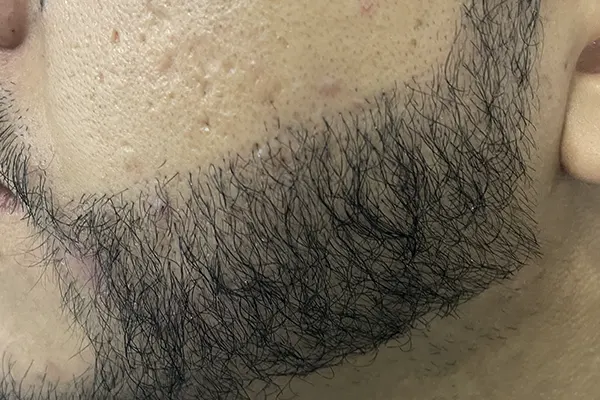 Img-Dra_Alexandra_Salazar-Antes&Despues-11-Despues