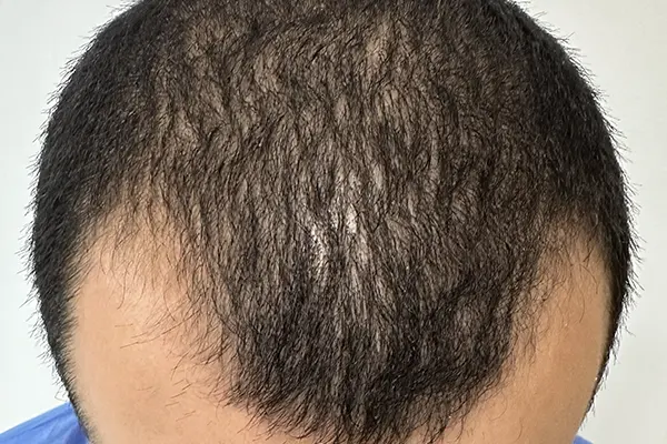 Img-Dra_Alexandra_Salazar-Antes&Despues-12-Antes