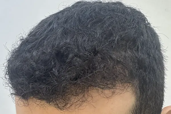 Img-Dra_Alexandra_Salazar-Antes&Despues-12-Despues