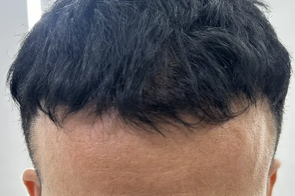 Img-Dra_Alexandra_Salazar-Antes&Despues-13-Despues