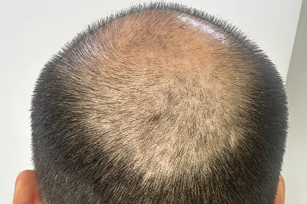 Img-Dra_Alexandra_Salazar-Antes&Despues-2-Antes