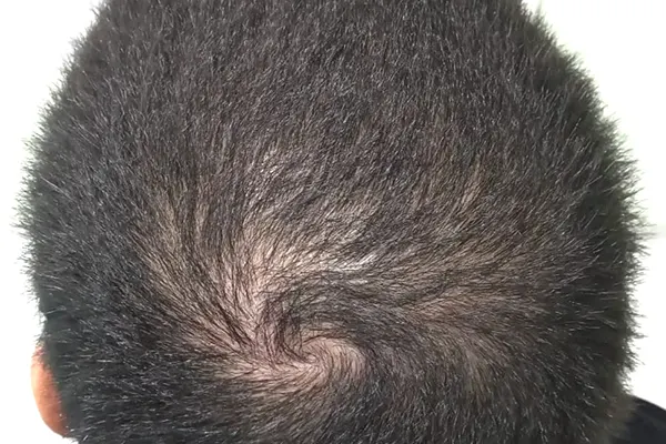 Img-Dra_Alexandra_Salazar-Antes&Despues-3-Despues