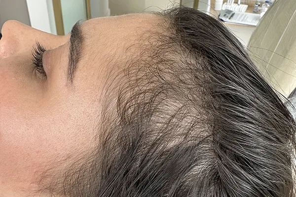 Img-Dra_Alexandra_Salazar-Antes&Despues-4-Antes