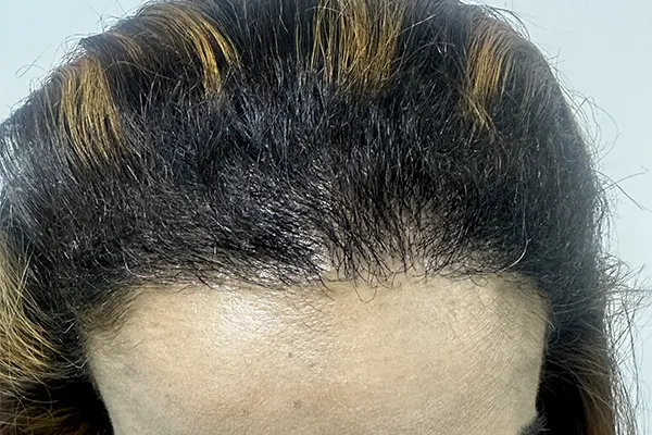 Img-Dra_Alexandra_Salazar-Antes&Despues-6-Despues