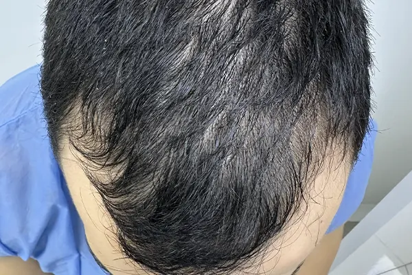 Img-Dra_Alexandra_Salazar-Antes&Despues-7-Despues