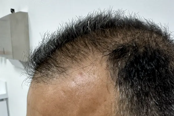 Img-Dra_Alexandra_Salazar-Antes&Despues-9-Antes