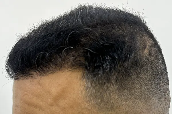 Img-Dra_Alexandra_Salazar-Antes&Despues-9-Despues