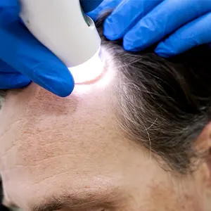 Img-clinica-capilar-en-medellin-Procedimientos-Tricólogo-LCP