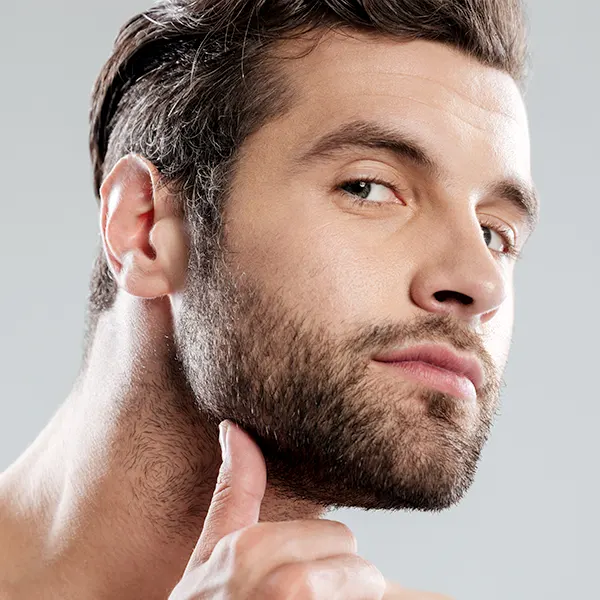 img-implante-de-barba-en-medellin-1