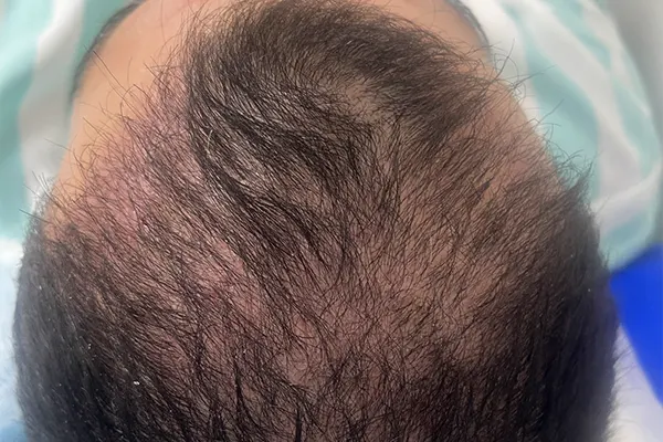 Img-Dra_Alexandra_Salazar-Antes&Despues-14-Antes