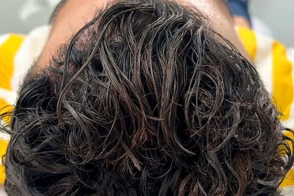 Img-Dra_Alexandra_Salazar-Antes&Despues-14-Despues