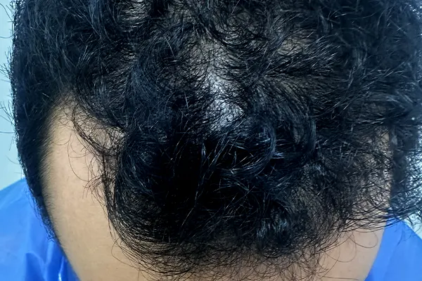 Img-Dra_Alexandra_Salazar-Antes&Despues-16-Antes