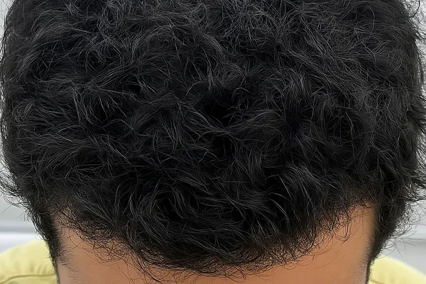 Img-Dra_Alexandra_Salazar-Antes&Despues-16-Despues