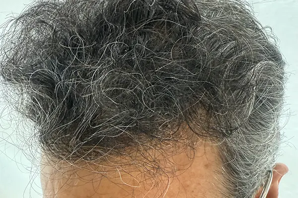 Img-Dra_Alexandra_Salazar-Antes&Despues-17-Despues