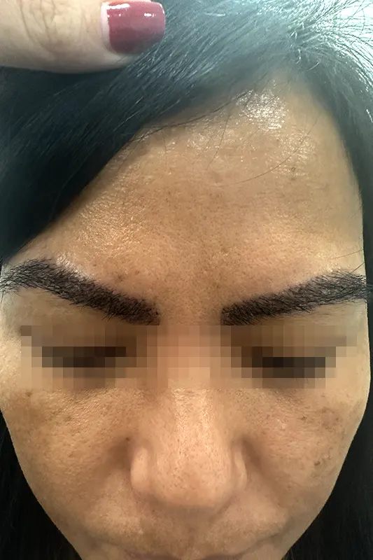 Img-Dra_Alexandra_Salazar-Beneficios-Cejas