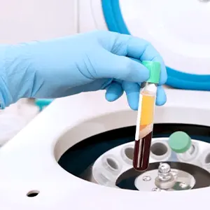 Img-clinica-capilar-en-medellin-Procedimientos-PRP-LCP-2026