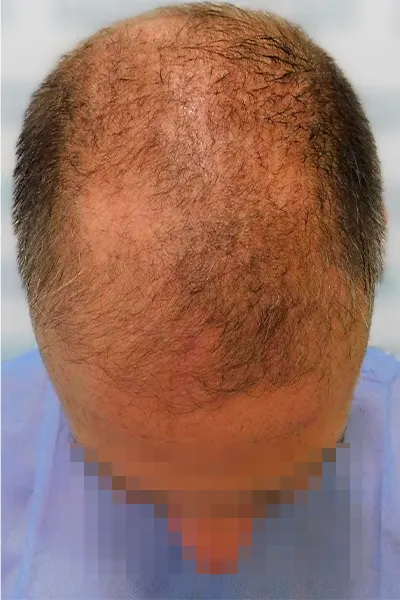 Img-Dra_Alexandra_Salazar-Antes&Despues-18-Antes