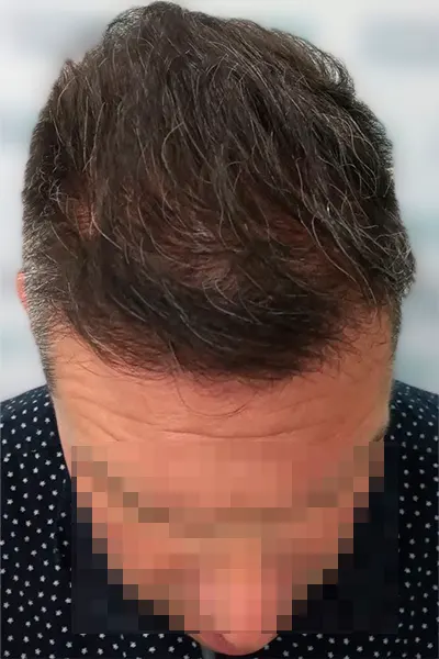 Img-Dra_Alexandra_Salazar-Antes&Despues-18-Despues