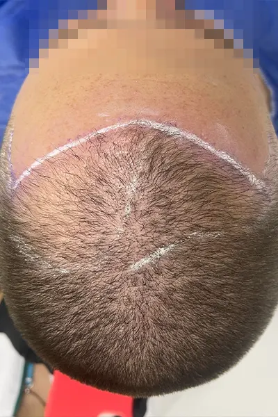 Img-Dra_Alexandra_Salazar-Antes&Despues-19-Antes