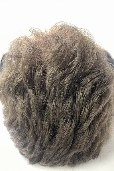 Img-Dra_Alexandra_Salazar-Antes&Despues-19-Despues