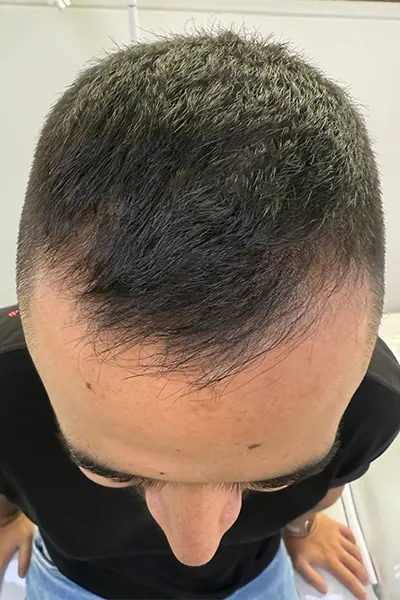 Img-Dra_Alexandra_Salazar-Antes&Despues-20-Antes