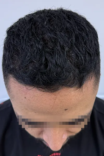 Img-Dra_Alexandra_Salazar-Antes&Despues-20-Despues