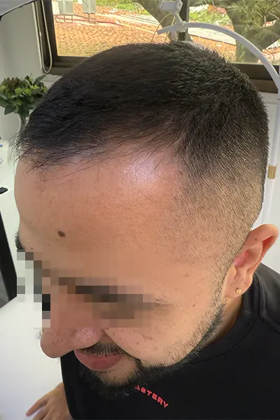 Img-Dra_Alexandra_Salazar-Antes&Despues-21-Antes