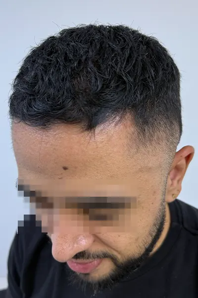 Img-Dra_Alexandra_Salazar-Antes&Despues-21-Despues