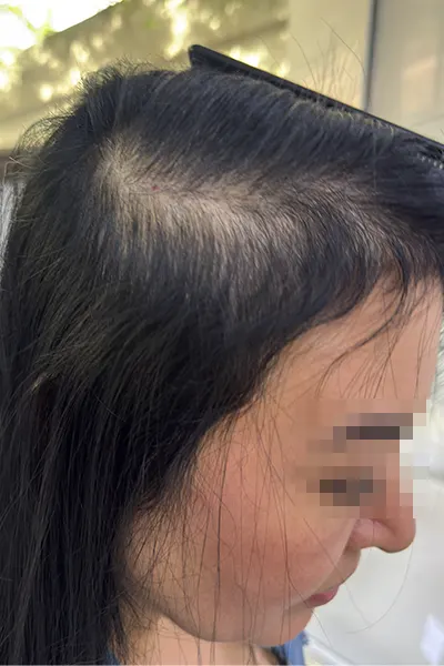 Img-Dra_Alexandra_Salazar-Antes&Despues-22-Antes