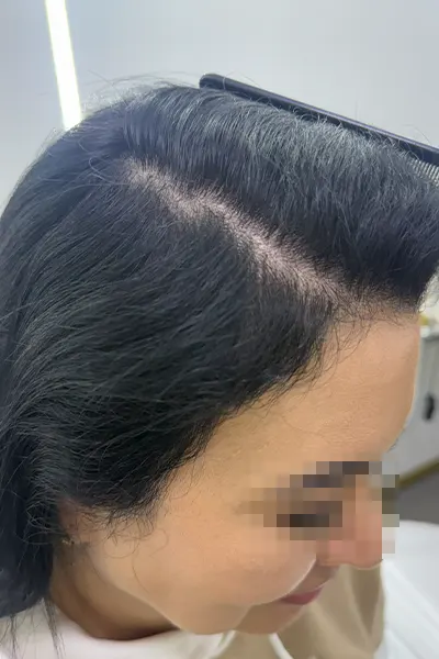 Img-Dra_Alexandra_Salazar-Antes&Despues-22-Despues