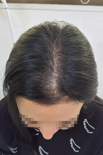 Img-Dra_Alexandra_Salazar-Antes&Despues-23-Antes