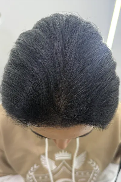 Img-Dra_Alexandra_Salazar-Antes&Despues-23-Despues