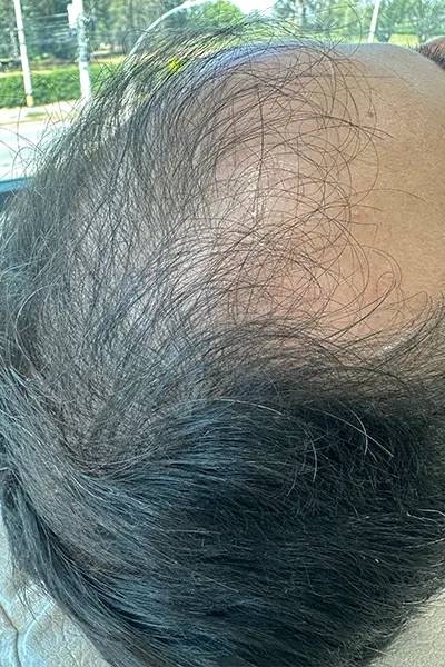 Img-Dra_Alexandra_Salazar-Antes&Despues-24-Antes