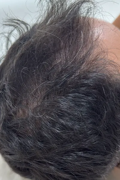 Img-Dra_Alexandra_Salazar-Antes&Despues-24-Despues