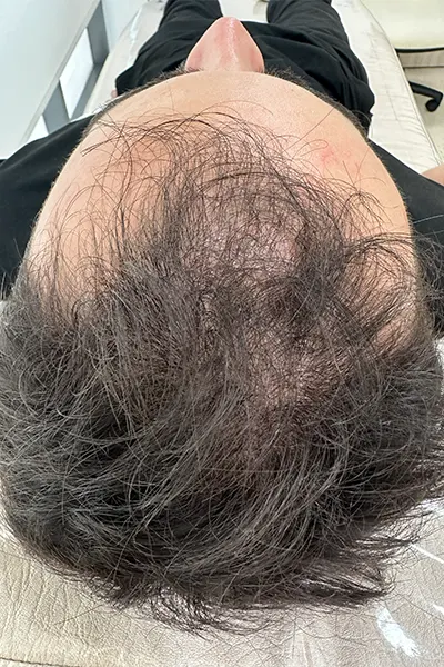 Img-Dra_Alexandra_Salazar-Antes&Despues-25-Antes