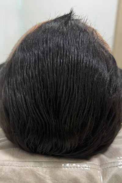 Img-Dra_Alexandra_Salazar-Antes&Despues-25-Despues