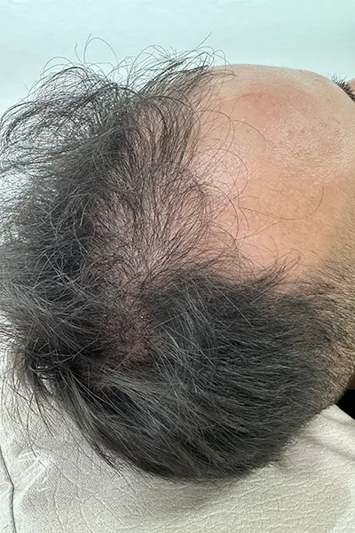 Img-Dra_Alexandra_Salazar-Antes&Despues-26-Antes