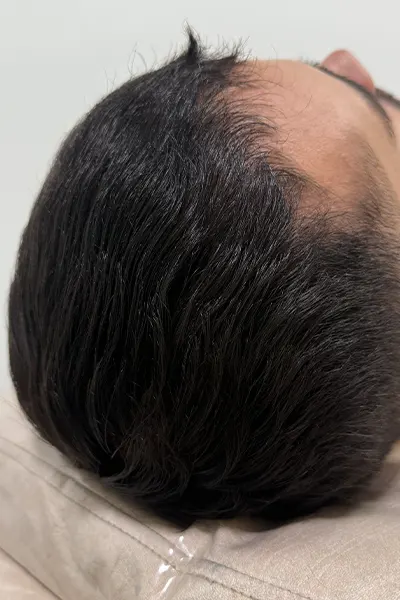 Img-Dra_Alexandra_Salazar-Antes&Despues-26-Despues